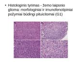 Labai reti galvos smegenų navikai 6 puslapis