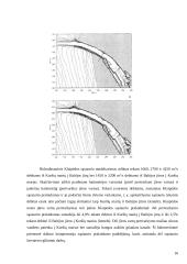 Naujos gilinimo darbų technologijos 16 puslapis